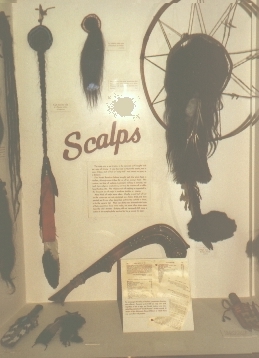Scalp Display